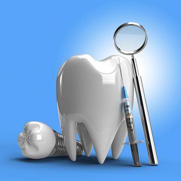 5 Tips To Help You Prepare For Dental Implant Surgery